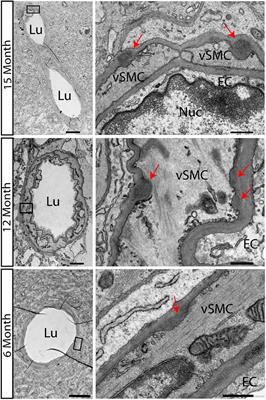 Notch3-Dependent Effects on Adult Neurogenesis and Hippocampus-Dependent Learning in a Modified Transgenic Model of CADASIL